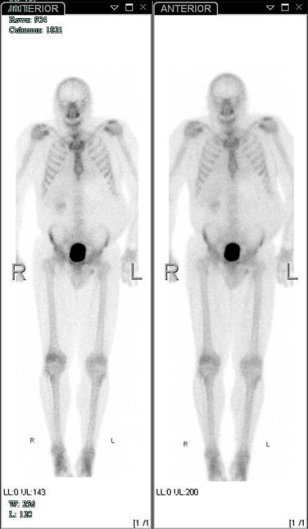 SKELETAL SCANS! - My Haloween Portrait?