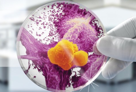 GcMAF ILLUSTRATION 01